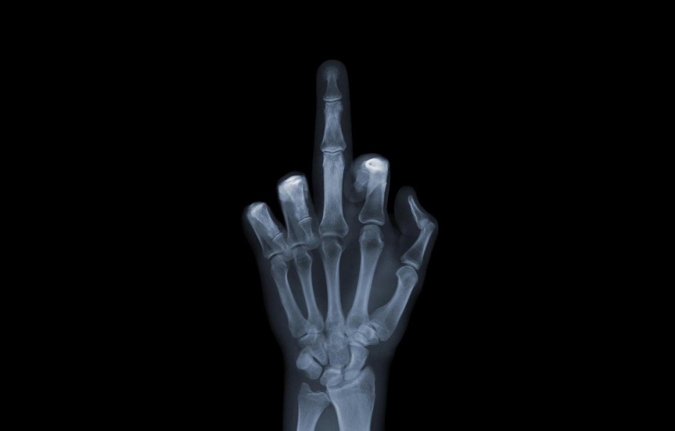 Radiografia mano dito medio, 1332x850 720p, Laptop