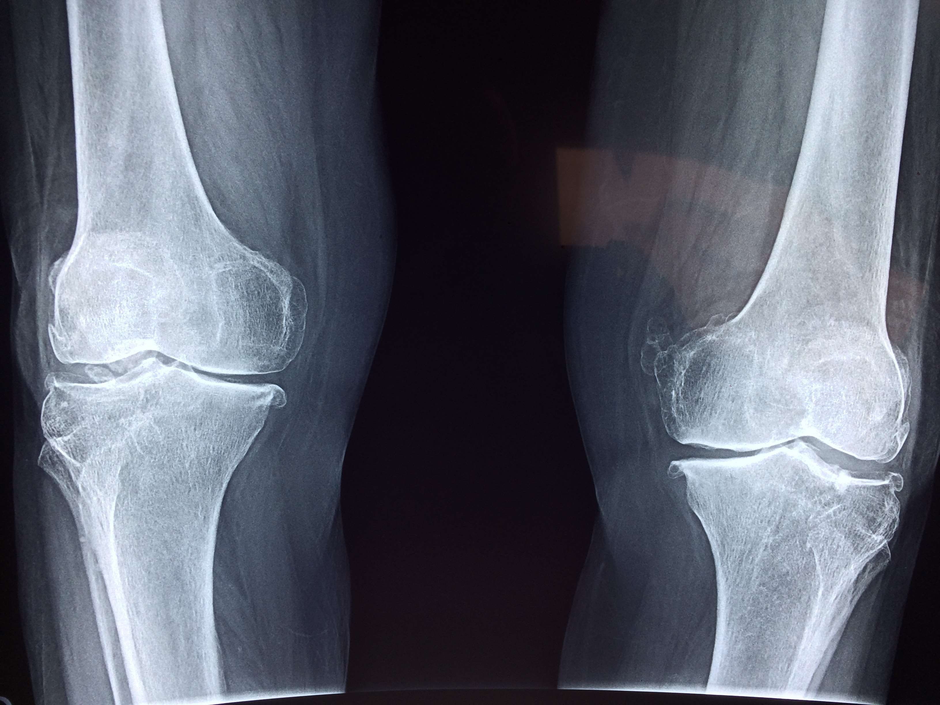 Radiografia spalla ortopedia blu, 1967x1000 Full HD, PC