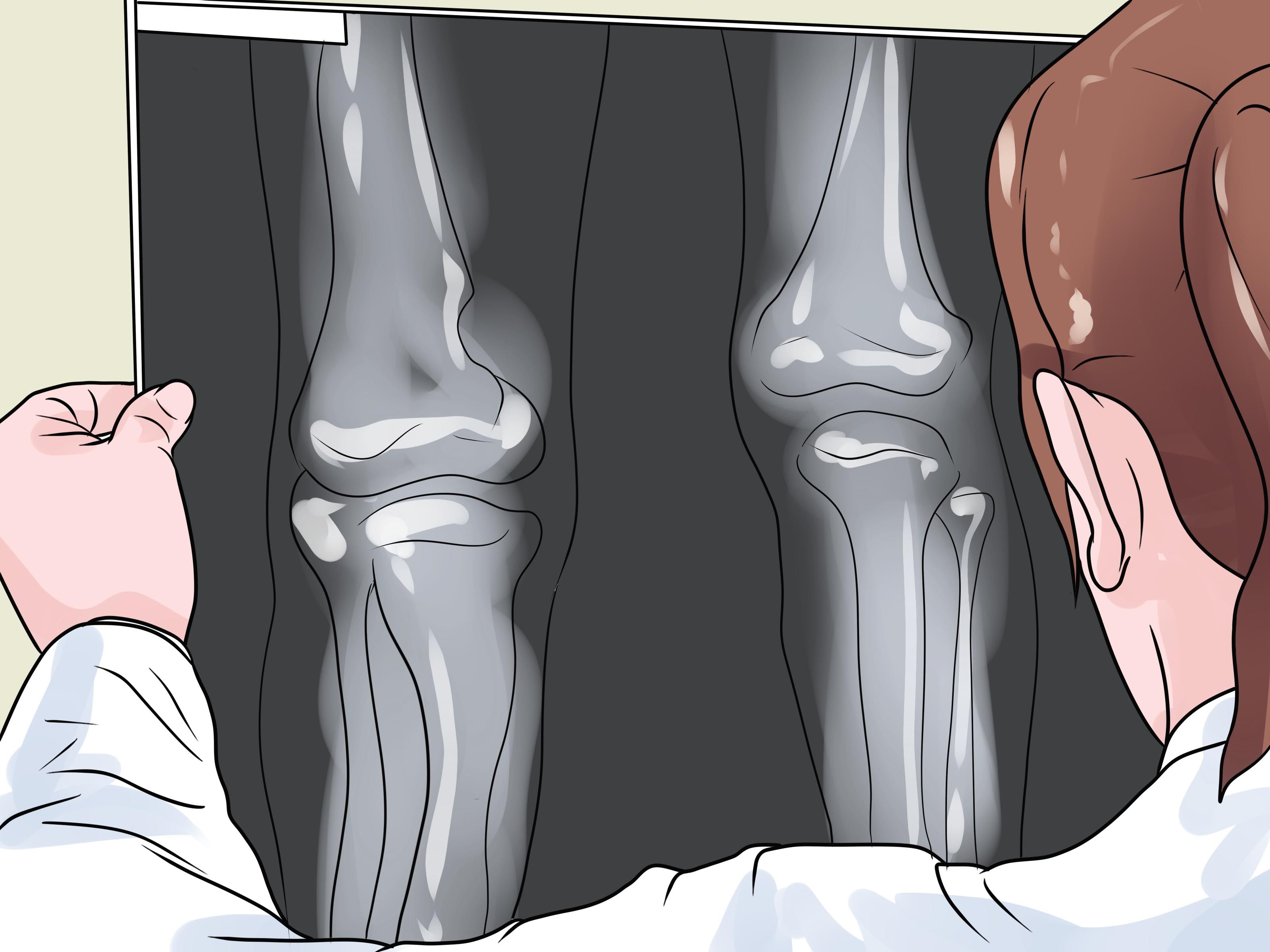 Scheletro Hinsdale Orthopaedics logo, 2560x1440 2K QHD, Monitor Gaming
