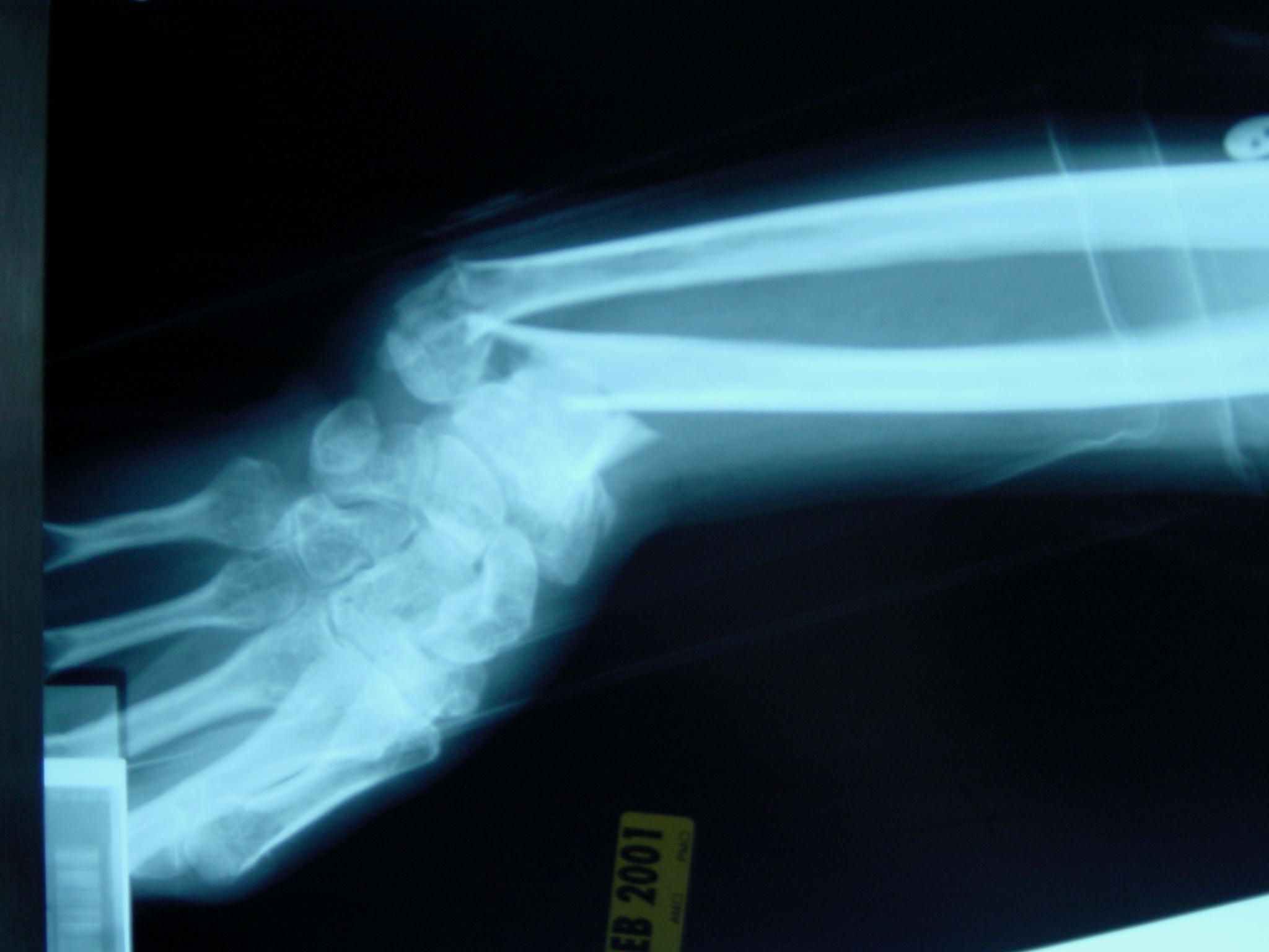 Griglia di radiografie ossa, 2560x1440 2K QHD, PC