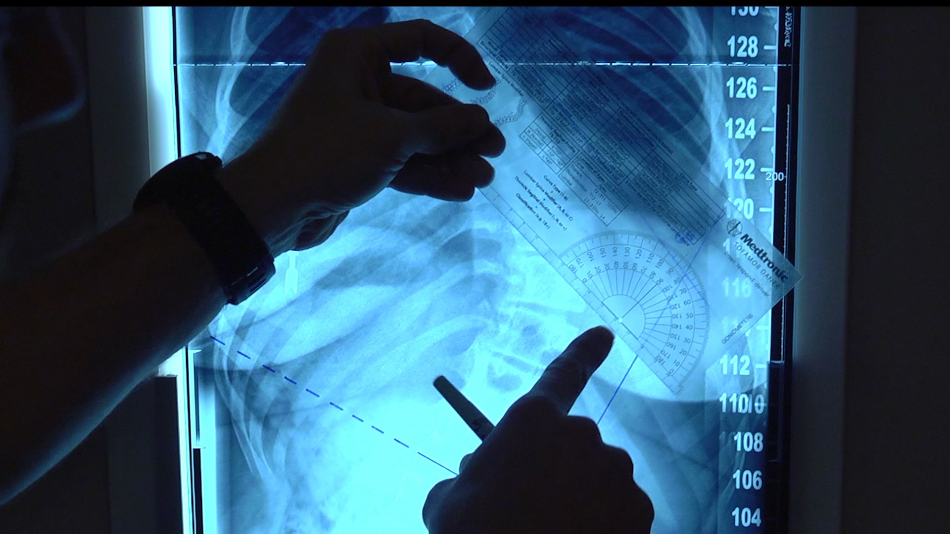 Tutore ortopedico polso FlexOH, 2560x1440 QHD, Laptop
