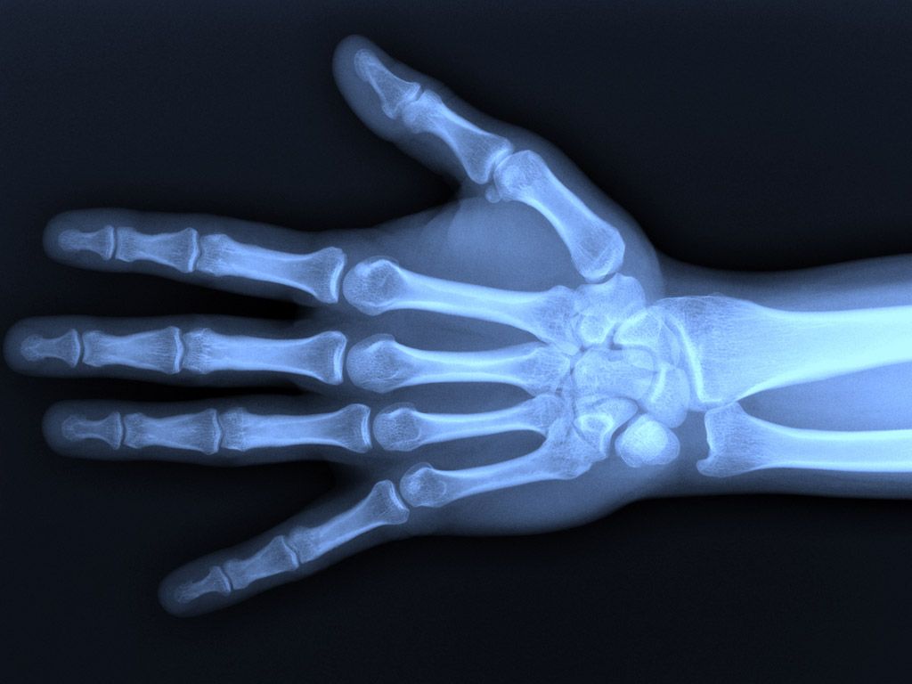 Radiografia mano ossa umane, 1024x768 HD, Desktop
