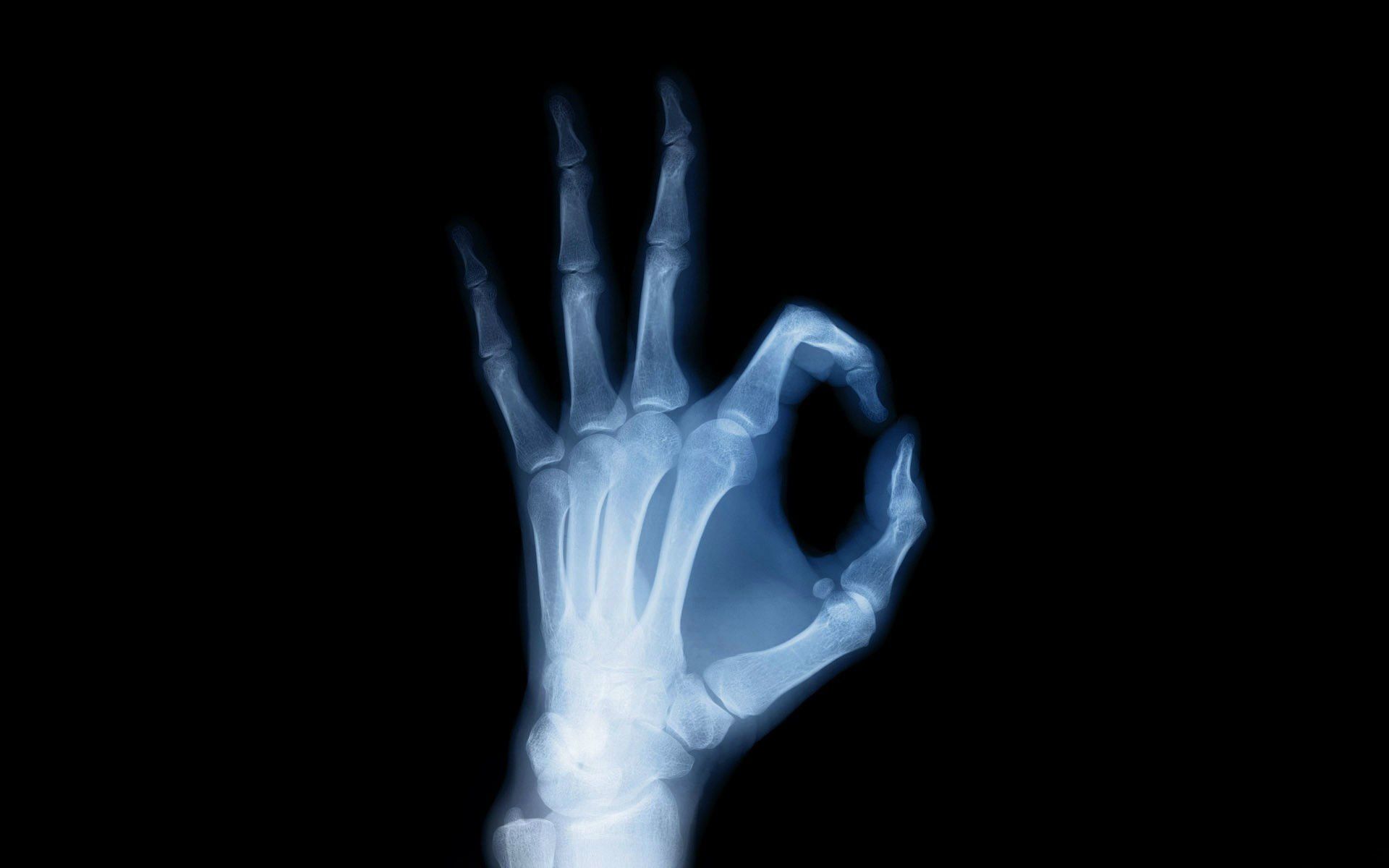 Radiografia mano gesto ok, 1920x1200 Full HD+, PC