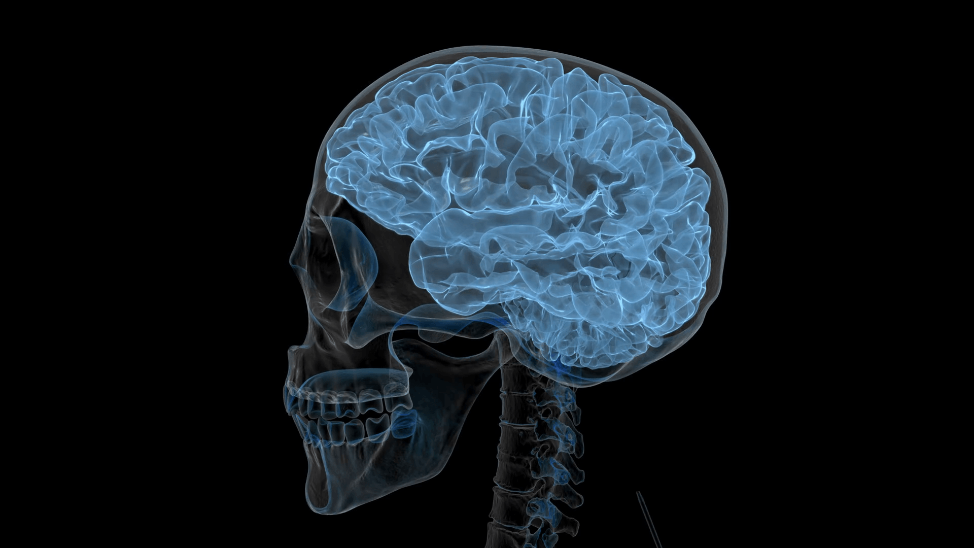 Radiografia cranio e cervello, 1920x1080 1080p, PC Desktop