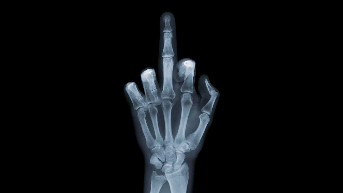 Radiografia mano dito medio, 1366x768 720p, Laptop