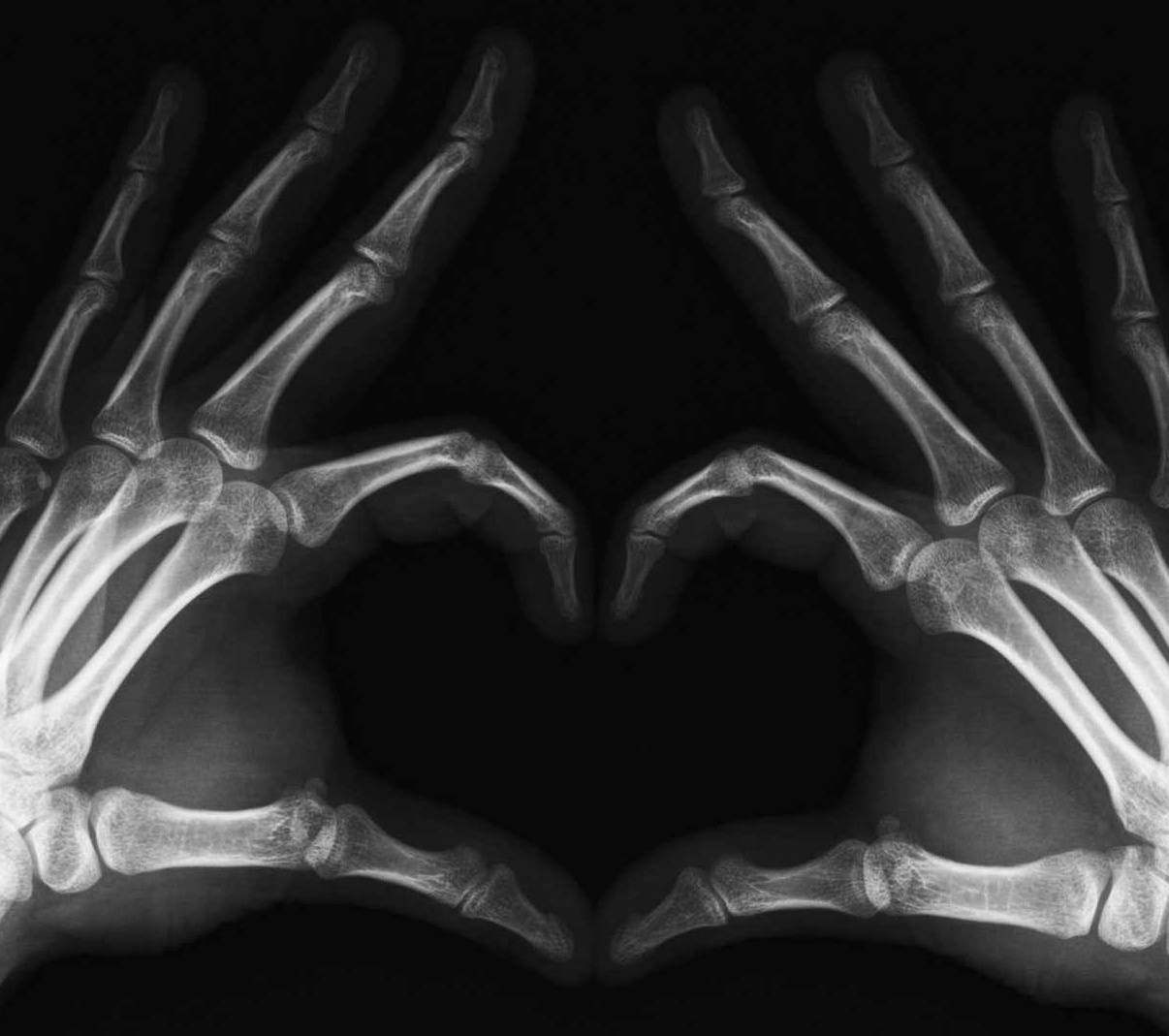 Radiografia mani a cuore, 1206x1069 HD, PC