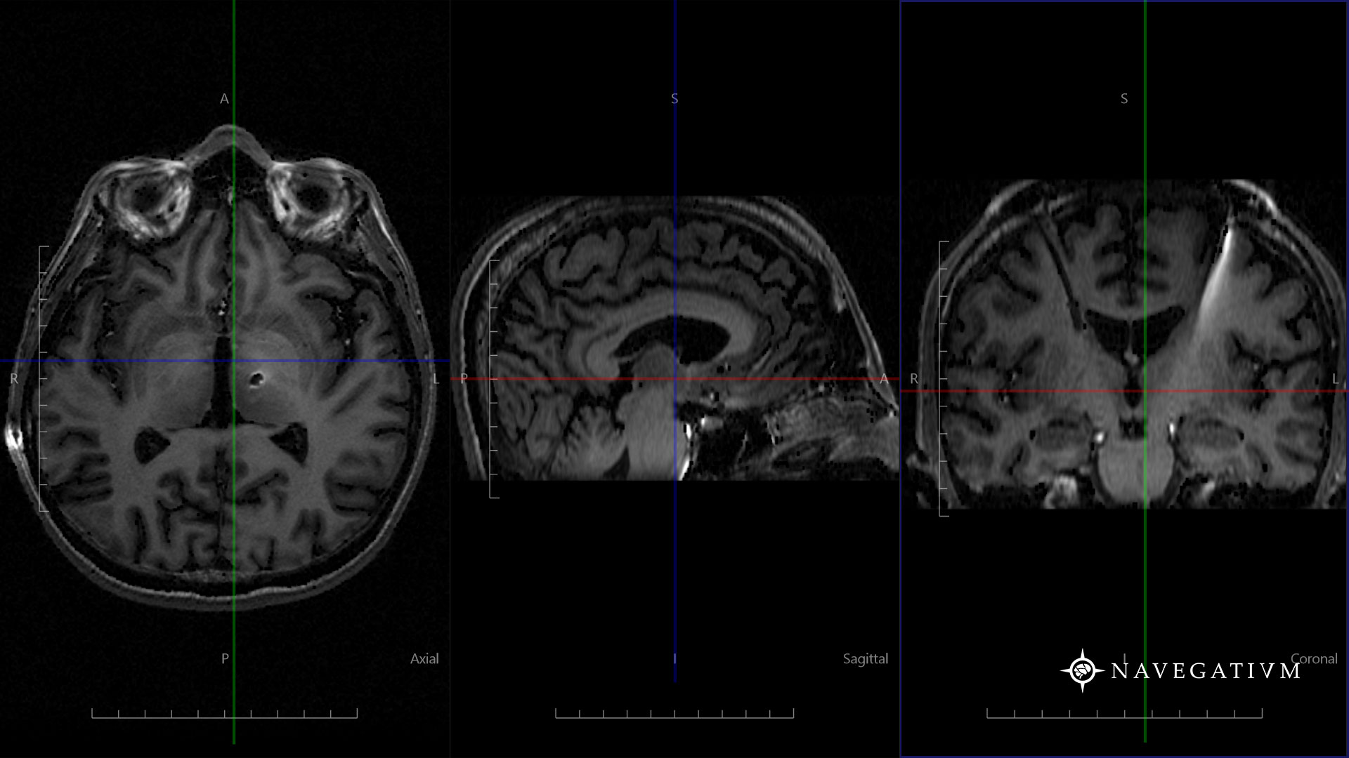 Scansioni MRI cervello, sfondo nero, 1920x1080 Full HD, PC Desktop