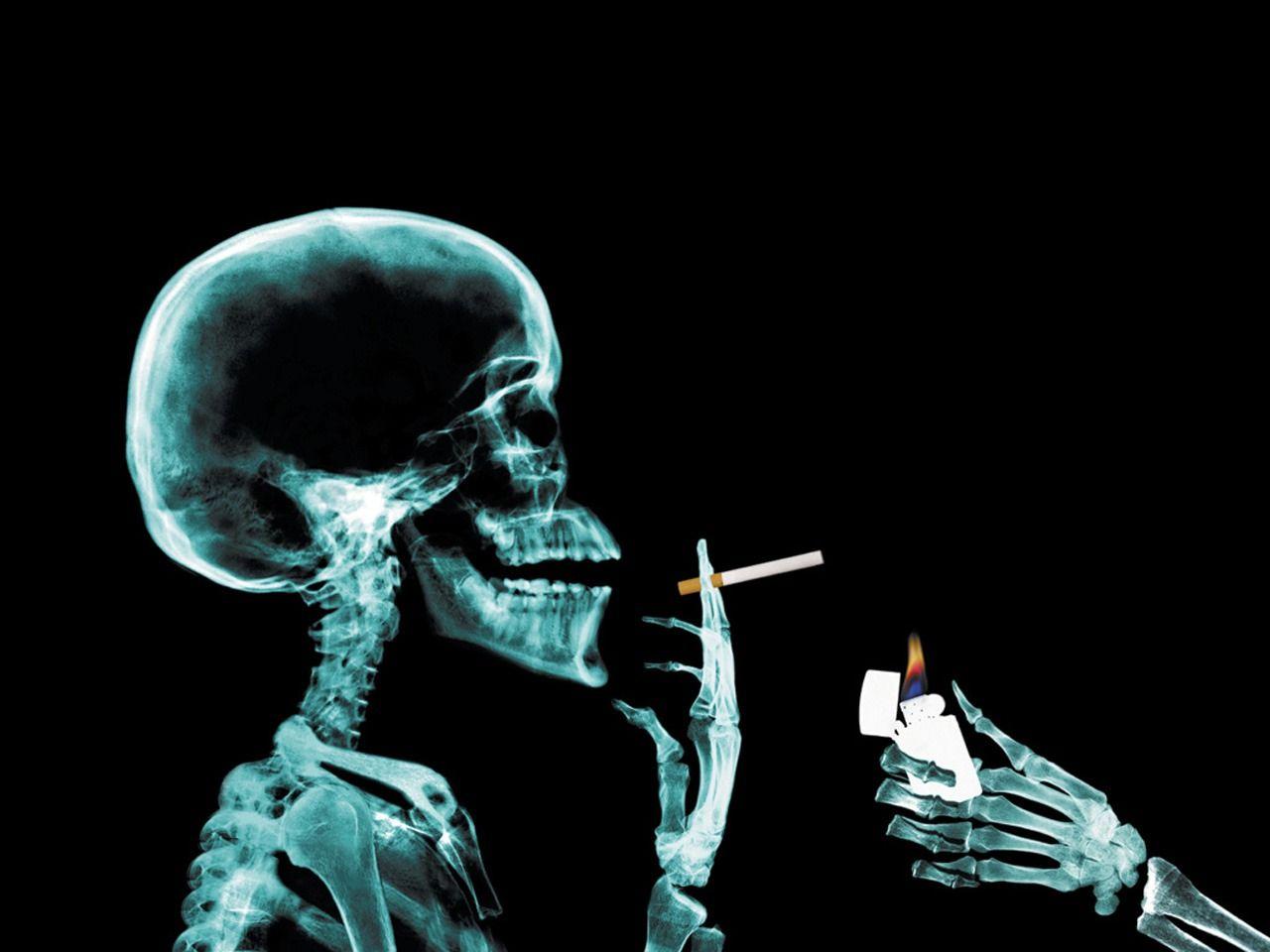 Scheletro raggi X che fuma, 1280x960 720p, PC