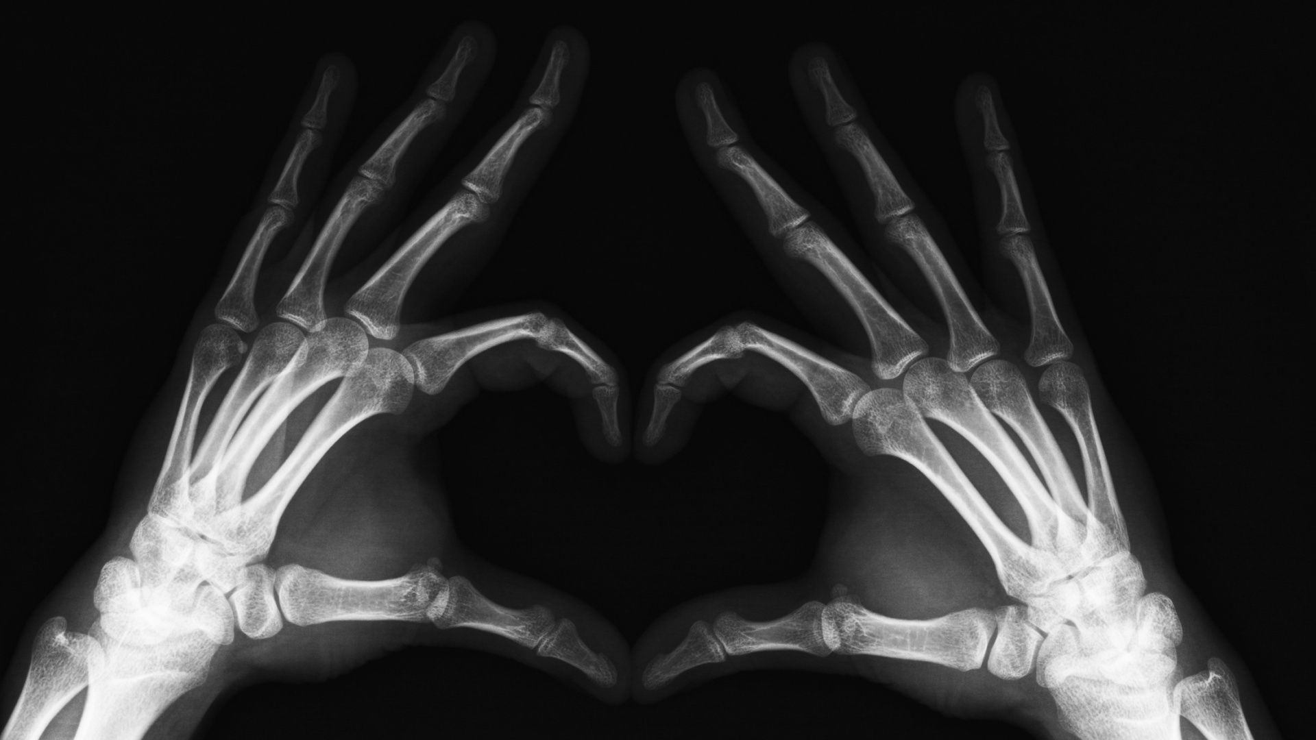 Radiografia mani a cuore, 1920x1080 Full HD 1080p, PC