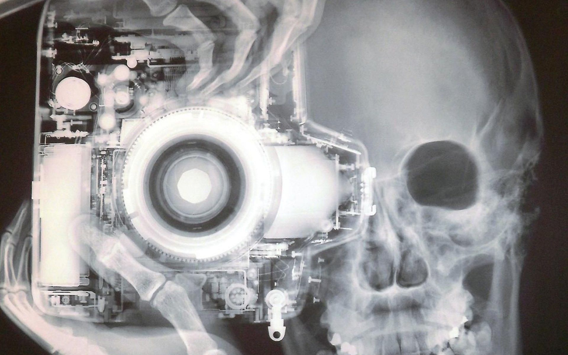 Radiografia cranio e macchina fotografica, 1920x1200 WUXGA, PC