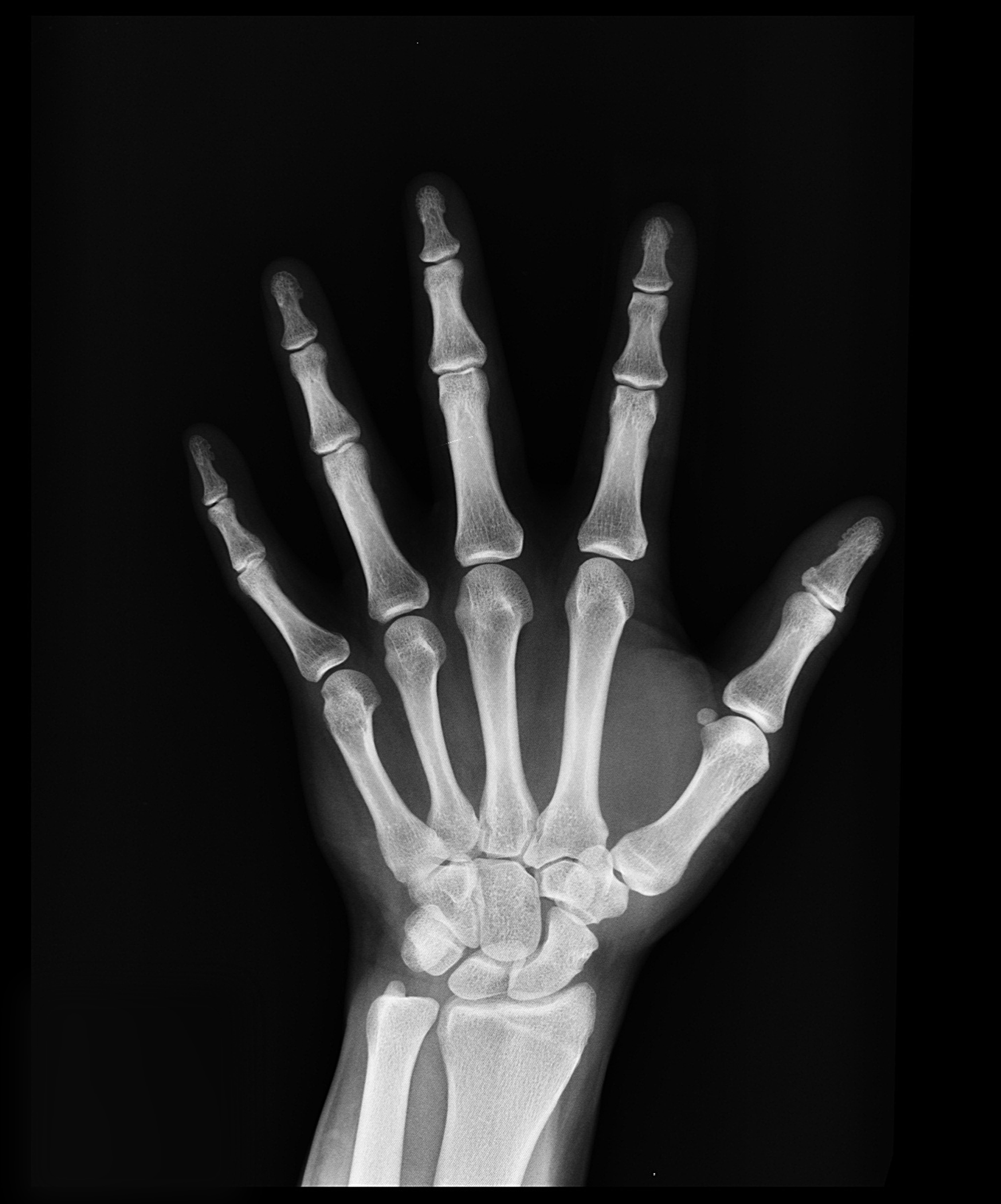 Radiografia mano ossa, 5967x7175 Full HD Verticale, Smartphone