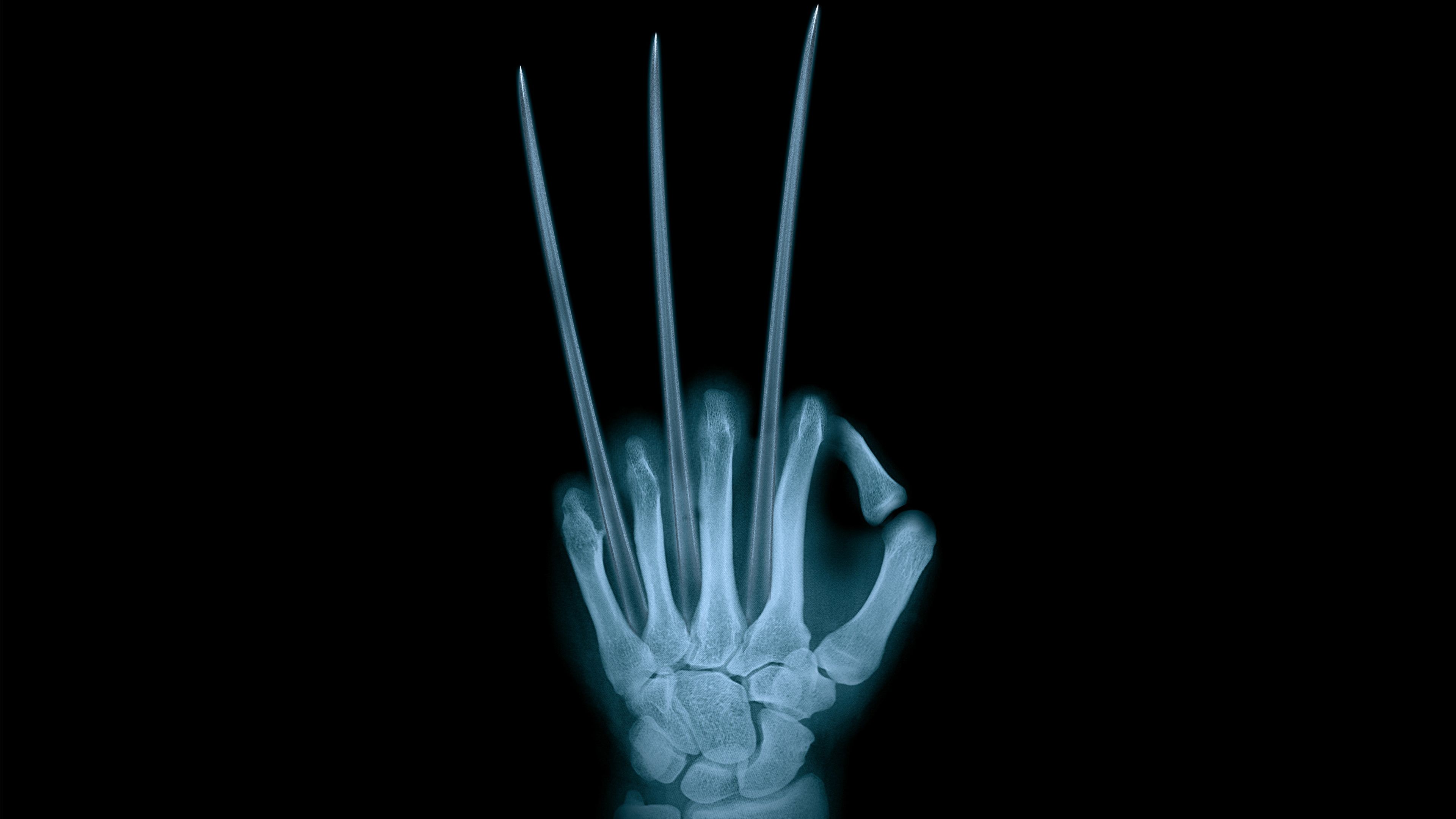 Radiografia mano artigli Wolverine, 3840x2160 4K Ultra HD, Monitor 4K
