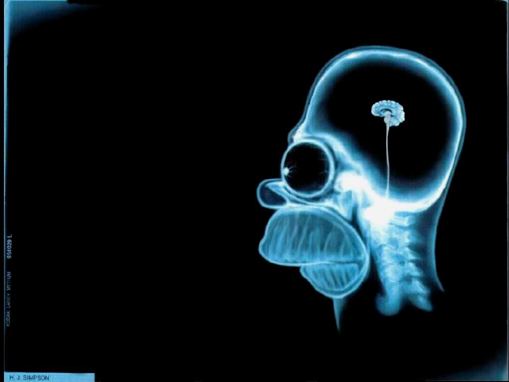 Homer Simpson radiografia cranio, serie animata, 1024x768 HD, Desktop