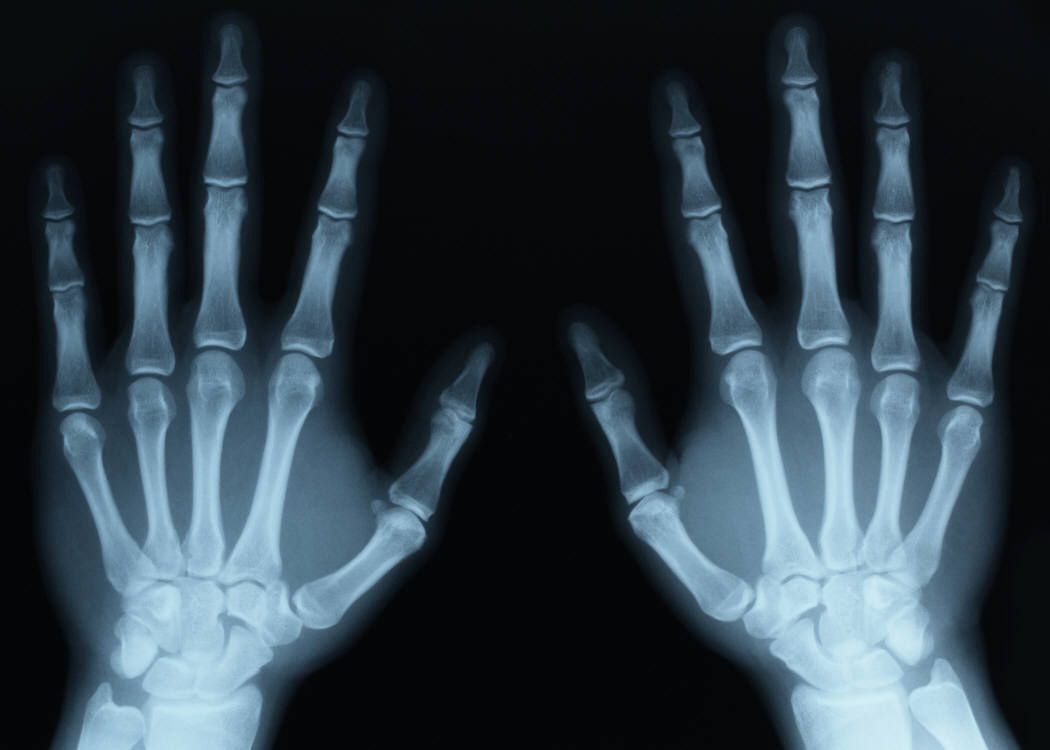 Radiografia di due mani, 1050x750 HD, PC