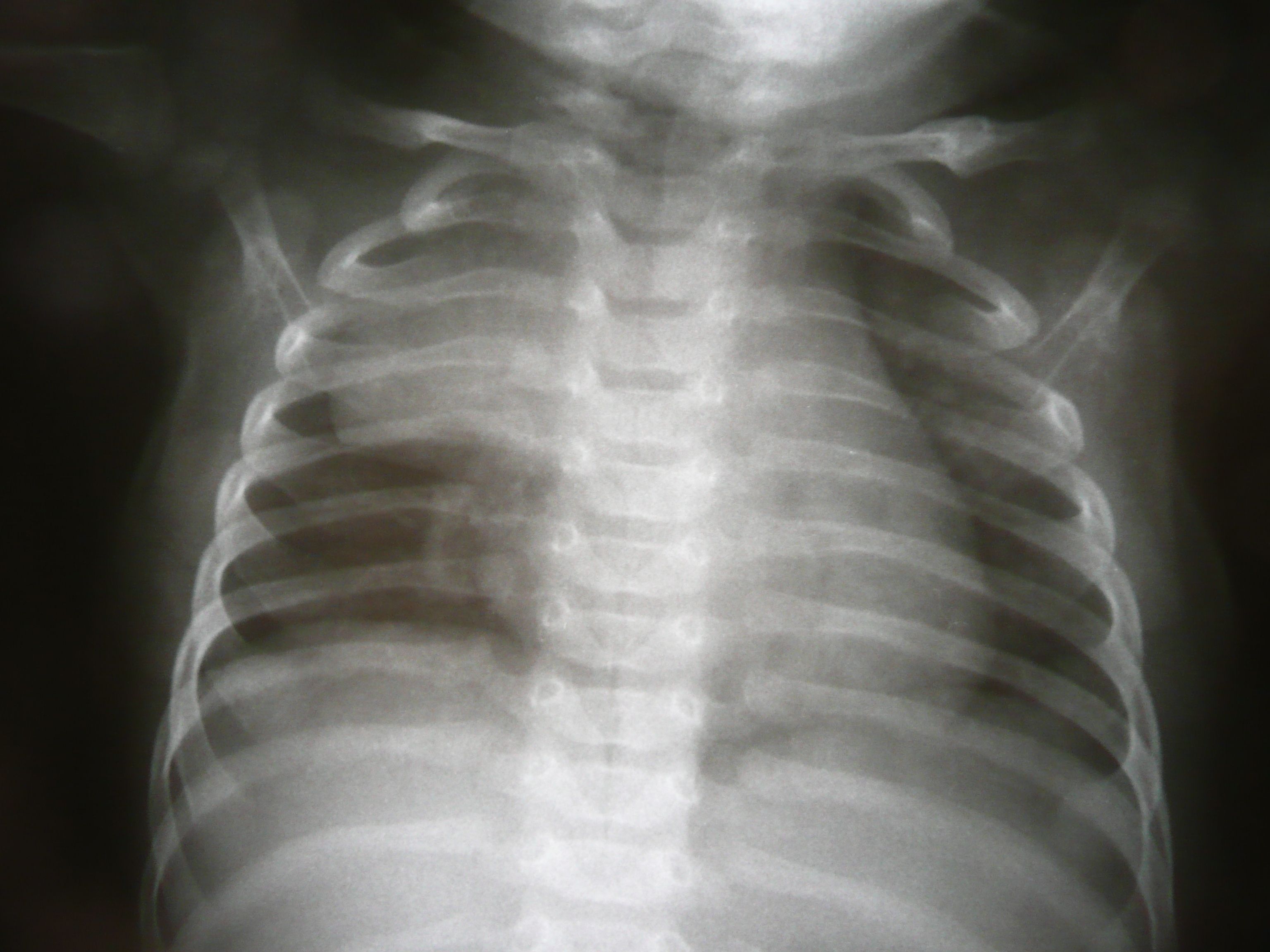 Scansioni cerebrali radiologia, 1366x768 720p, Laptop