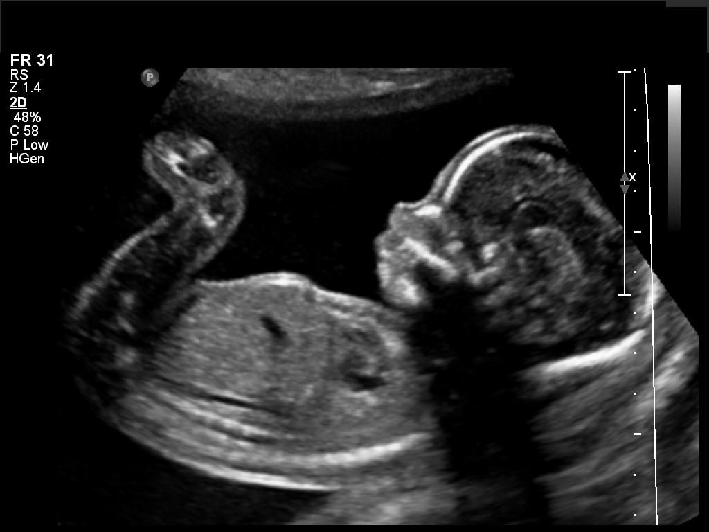 Radiografia mano con mouse, 1024x768 HD, PC Desktop