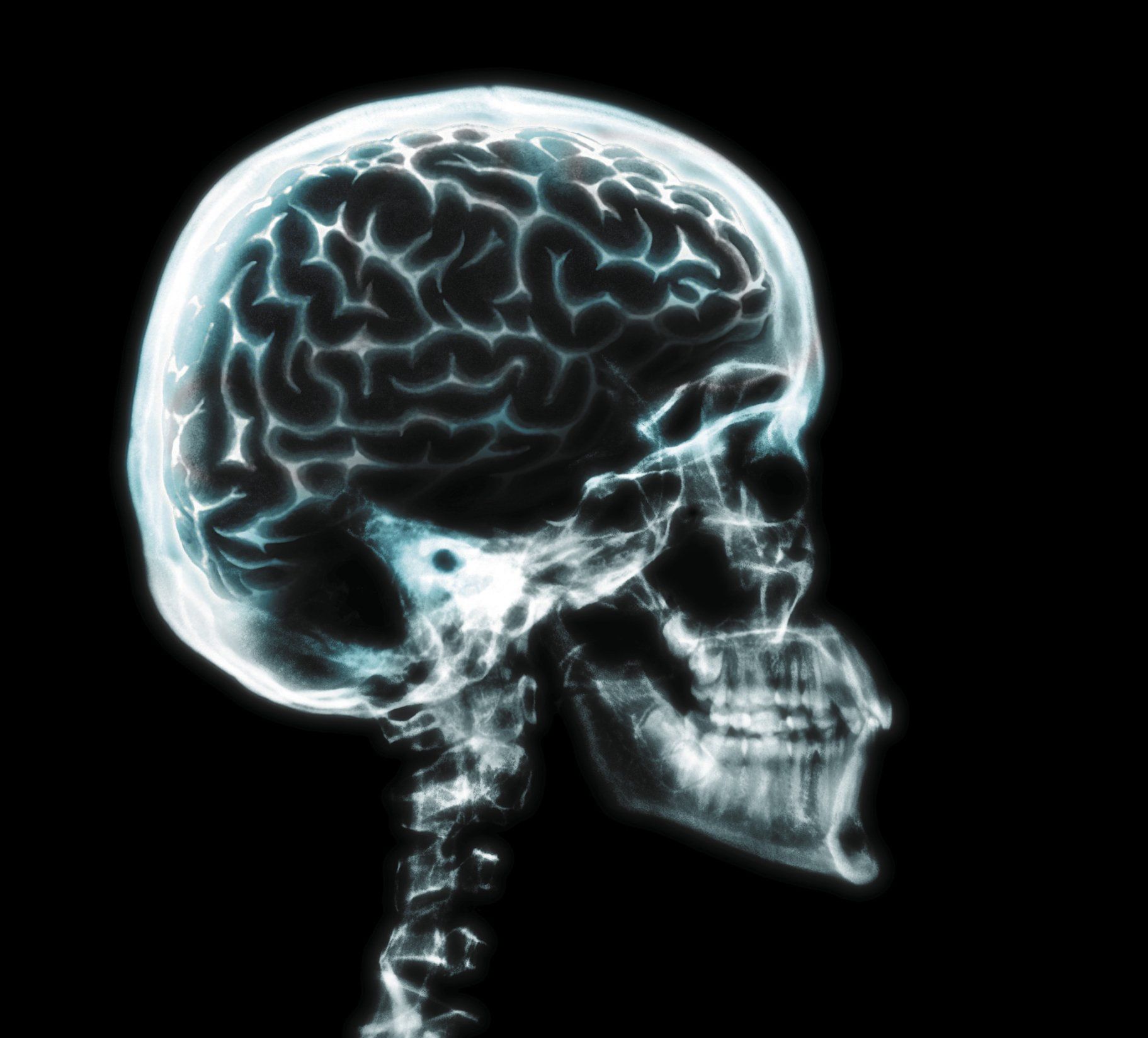 Radiografia cranio e cervello, 1823x1648 HD Ready, Desktop