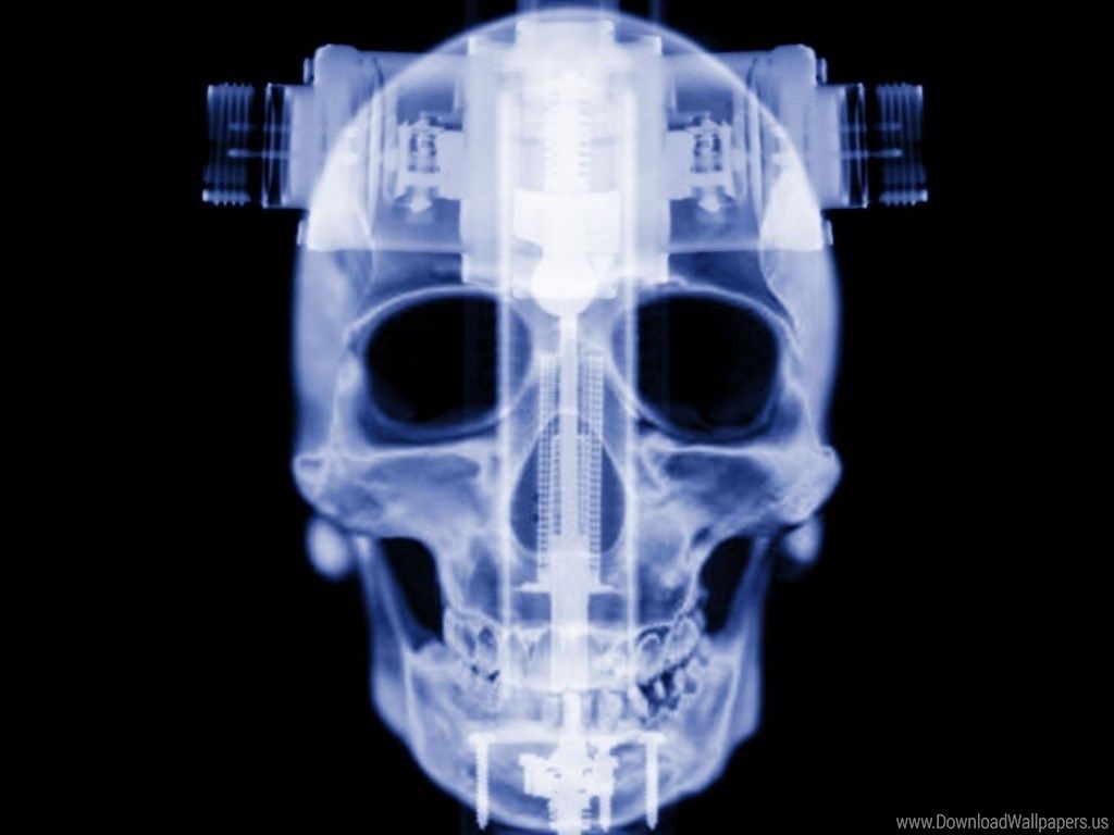 Radiografia teschio con dispositivo, 1024x768 HD, Desktop