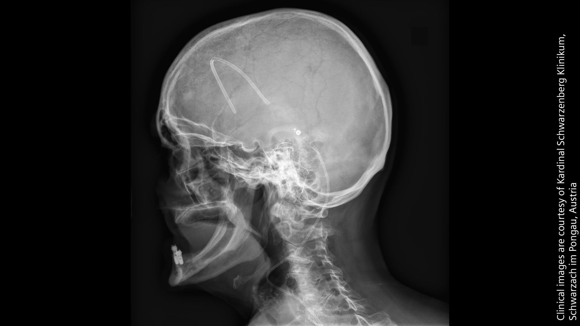 Radiografia cranio profilo, 1920x1080 Full HD 1080p, Desktop