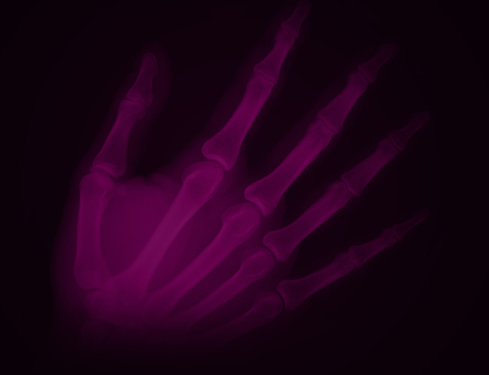 Radiografia mano viola, 1700x1303 HD, PC
