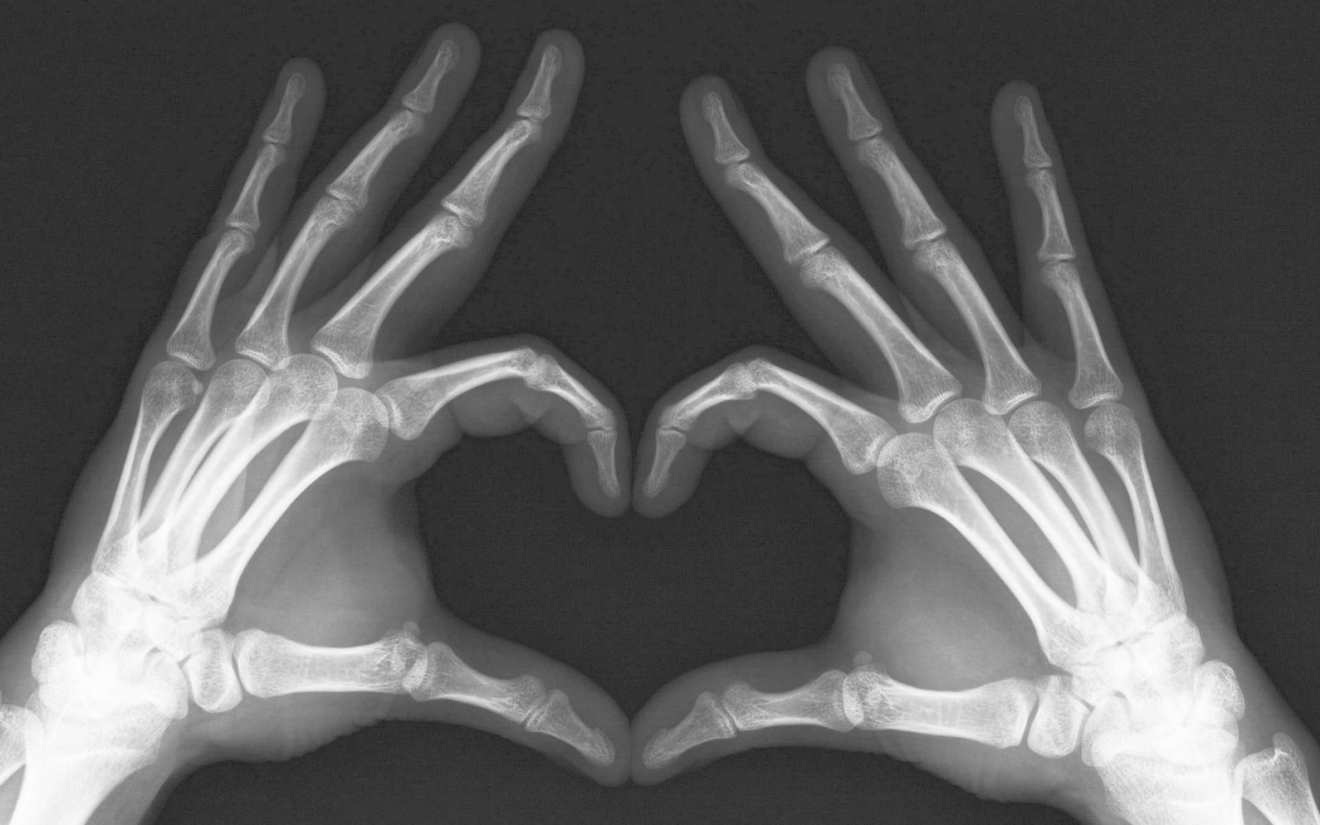 Raggi X mani a cuore, 1920x1200 WUXGA, PC