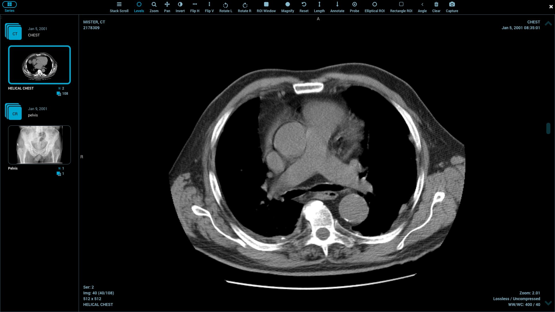 Radiografia donna tacchi alti, 1772x1119 900p, iMac