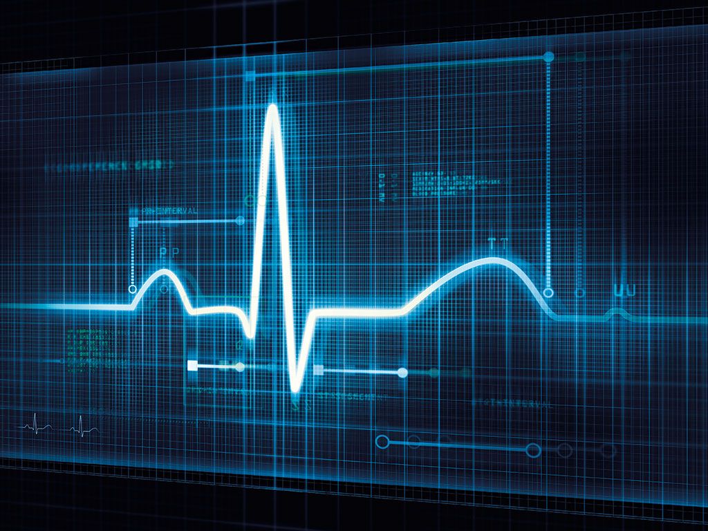 Tracciato ECG blu digitale, 1024x768 HD, Laptop