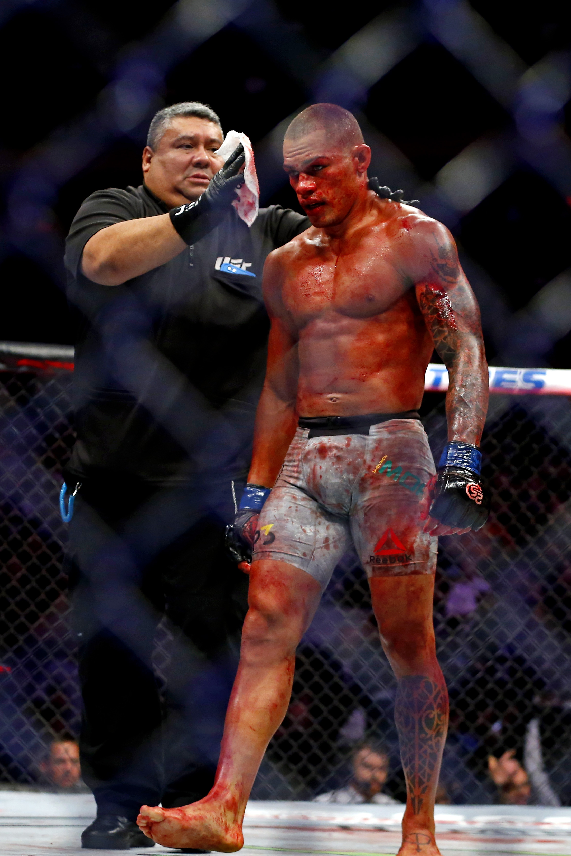 Lottatore UFC insanguinato in gabbia, 2223x3335 Full HD Verticale, iPhone